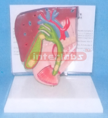 DESK-TYPE, GALLSTONE DEMONSTRATING MODEL WITH DESCRIPTION PLATE